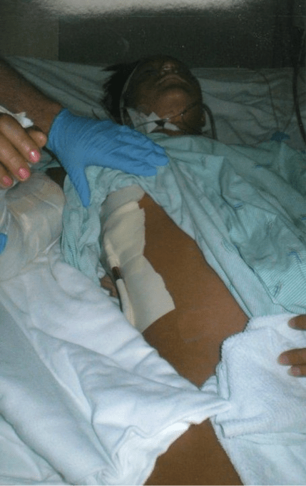 chest tube in hospital